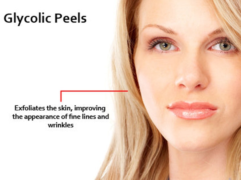 GLYCOLZUUR Chemische Peel Kit Revitaliseer uw huid Natuurlijke exfoliërende behandeling Een alfahydroxyzuur afbeelding 3