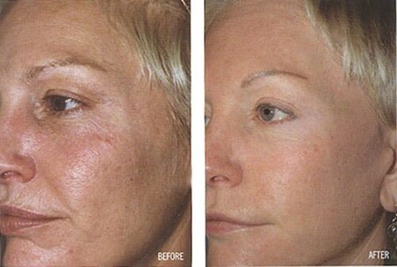 Collagen Facial Serum Peptides Coq10 Hyaluronic Acid W/ - Etsy Collagen Facial Serum Peptides Coq10 Hyaluronic Acid W/ - Etsy