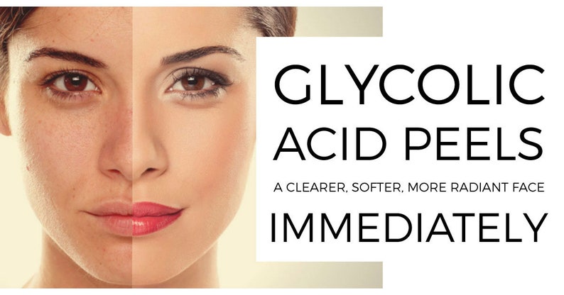 GLYCOLZUUR Chemische Peel Kit Revitaliseer uw huid Natuurlijke exfoliërende behandeling Een alfahydroxyzuur afbeelding 5