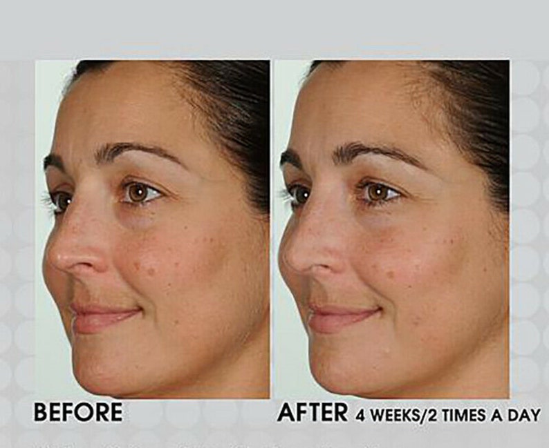 Ретинол до и после отзывы Новые концентраты от Lancôme Visionnaire skin solutions: Витамин С и Ретинол Отз