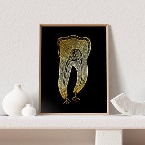 Dental Hygienist Gift - RDH Gift - Dental Art Print - Dentist Gift - Dental Office Decor - Gold Foil Print - Tooth Art - 8.5x11 inches