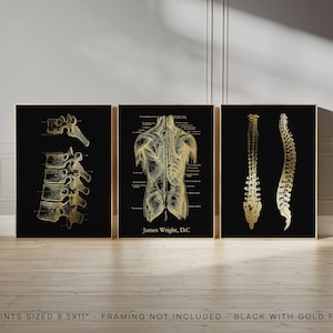 Regalo personalizado de quiropráctico, arte de pared de 3 piezas - Impresión artística personalizada de quiropráctico - Arte de columna vertebral - Arte de vértebras - Impresión en lámina dorada - 8,5 x 11 pulgadas