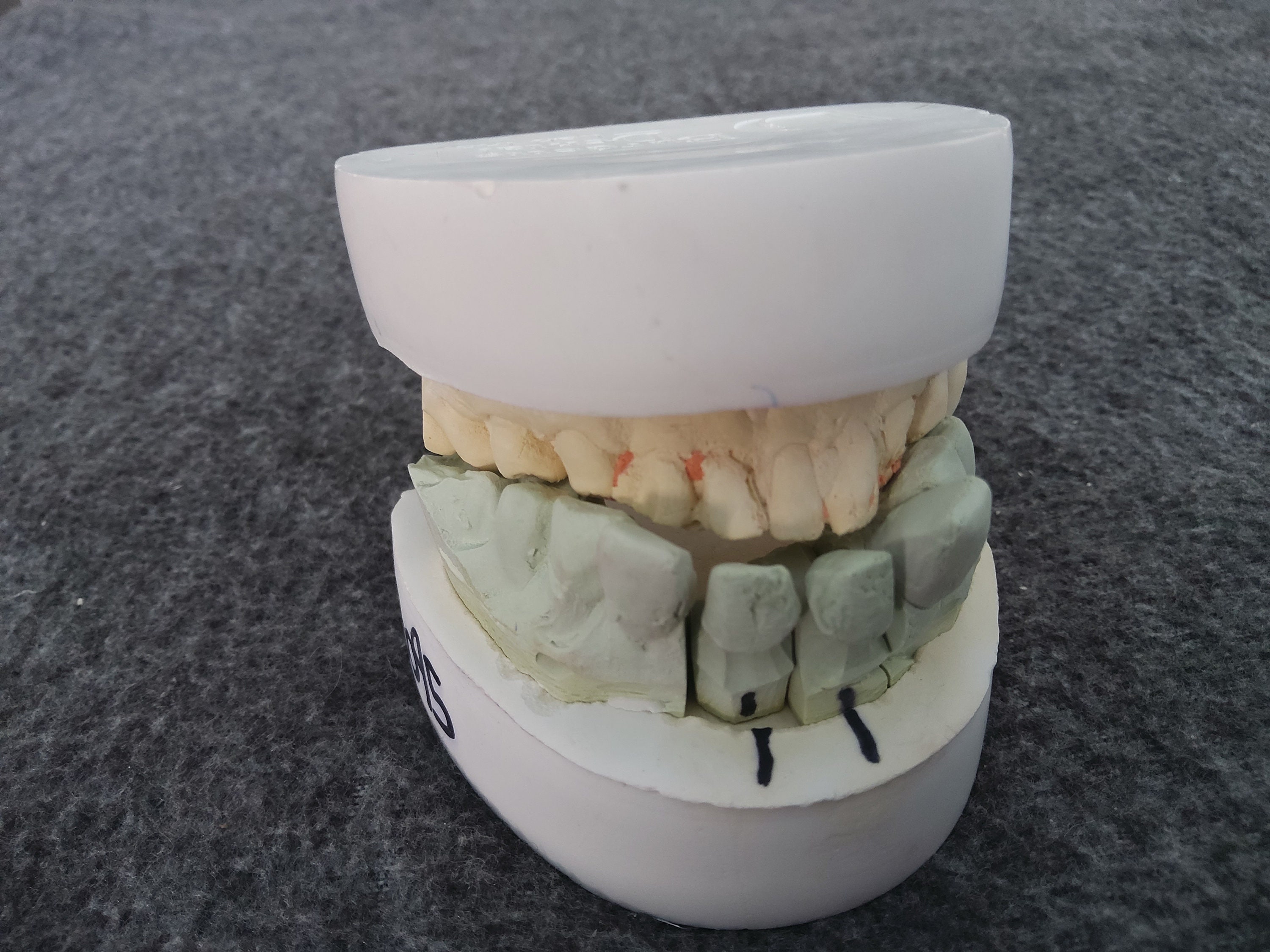 Disease Teeth Model, Dental Mold, Clear Dental Teeth Model, Vintage Medical  