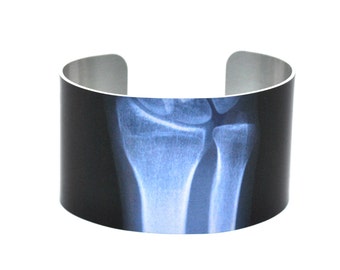 X-ray von Aluminium-Manschette
