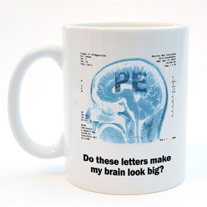 May include: White ceramic mug with a blue and white brain scan image and the text "Do these letters make my brain look big?" printed on it.