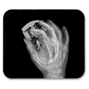 X-ray Mousepad