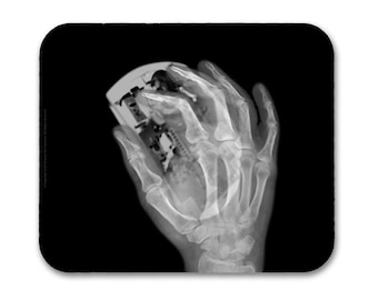 X-ray Mousepad