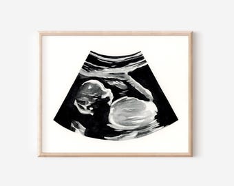Acquerello ecografico dipinto a mano: arte personalizzata per la cameretta dei bambini