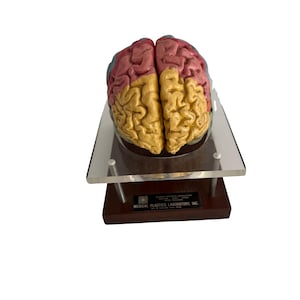 Mid Century Anatomical Brain Model by Medical Plastic Laboratory