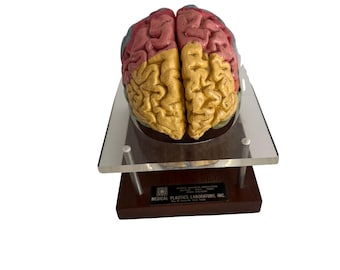Mid Century Anatomical Brain Model by Medical Plastic Laboratory