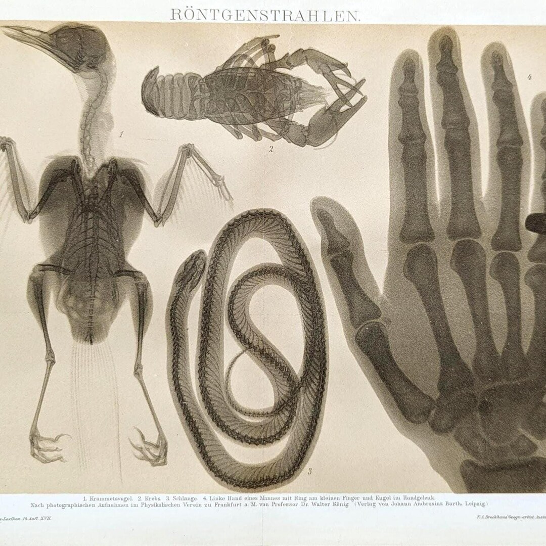 X-ray Antique Lithograph From 1897, Radiography, Scientific Print ...