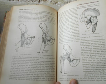 French antique surgical book from 1907. Rare illustrated medical book, surgery encyclopedia volume.