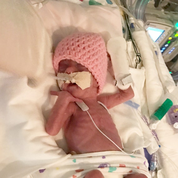 2 pound preemie