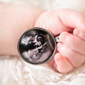 Ultrasound Photo Necklace Personalized with Your Baby&#39;s Picture (Handcrafted, Pendant Necklace, Sonogram Necklace, Pregnancy Announcement)