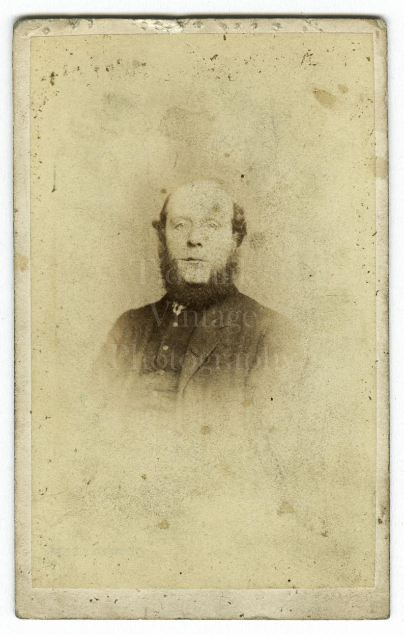 Carte de Visite Antique Photograph Neck Beard Portrait Manchester England CDV Photo Victorian Bald Man