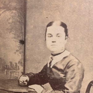 Antique Victorian Photo of a Young Woman with a Strangely Swollen Face - Medical - Oddity - Curiosity - Carte de Visite