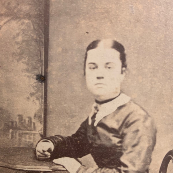 Unusual Antique Victorian Carte de Visite Photo of a Young Woman with a Strangely Swollen Face - Medical - Oddity - Curiosity