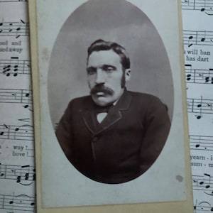 Antyczne wiktoriańskie zdjęcie CDV Carte De Visite - Mężczyzna z zespołem Klippela Feila - Zainteresowania medyczne - Osobliwość - Ciekawość - Niezwykłe