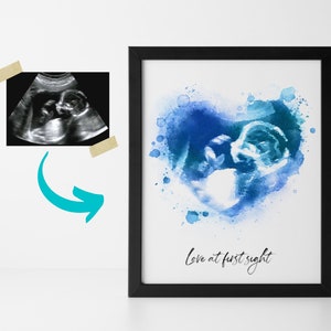 Könnte beinhalten: Gerahmter Druck mit einem Aquarellherz in Blautönen und einem Ultraschallbild des Babys in der Mitte. Der Satz "Love at first sight" steht darunter. Ein separates Ultraschallbild ist links angebracht.