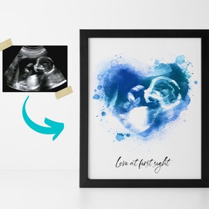 Custom Ultrasound Art Print Sonogram Gift New Baby Personalized Gift - Baby Ultrasound Watercolor Art Print Baby Keepsake New Mom Gift