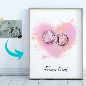 Custom Embryo Painting Heart Watercolor IVF Gift Personalized Surrogate Gift for Parents - Nursery Wall Art IVF Pregnancy Announcement