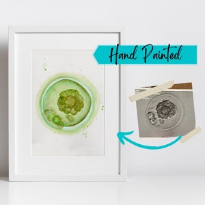 Watercolor Embryo Painting IVF Gifts - Hand Painted Custom Art Personalized Nursery Art - IVF Baby Surrogate Gift Embryo Transfer