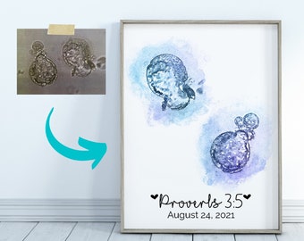 Twin IVF Art Two Embryos Watercolor Custom Personalized Pregnancy Gift - Nursery Wall Art In Vitro Pregnancy Art Print Transfer Day Gift