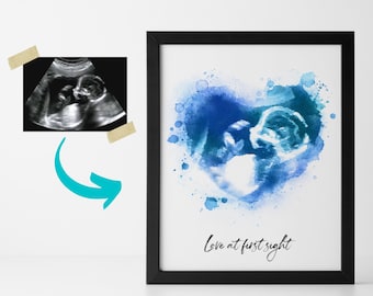 Custom Ultrasound Art Print Sonogram Gift New Baby Personalized Gift - Baby Ultrasound Watercolor Art Print Baby Keepsake New Mom Gift