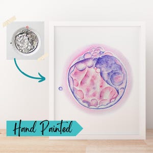 Mothers Day Gift Embryo Watercolor Painting Custom Embryo Art - IVF Art Baby Shower Gift Surrogate Gift Embryo Transfer IVF Mom Gift