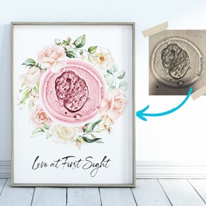 Custom Embryo Art Print Floral Watercolor Roses Nursery Decor - IVF Baby Announcement Embryo Watercolor Botanical Nursery Wall Art Print