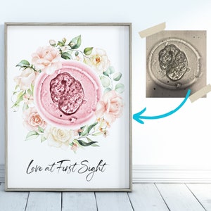 Impresión artística personalizada de embriones con acuarela floral y rosas para decoración de guardería - Anuncio de bebé de FIV con embriones, acuarela botánica, arte mural para guardería