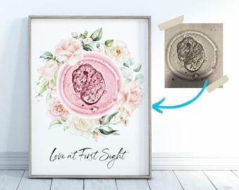 Custom Embryo Art Print Floral Watercolor Roses Nursery Decor - IVF Baby Announcement Embryo Watercolor Botanical Nursery Wall Art Print