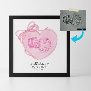 Impresión personalizada de vivero de arco de arte de FIV de acuarela de embriones - Pintura digital personalizada de anuncio de embarazo de FIV - Pérdida de embriones de arte de fertilidad