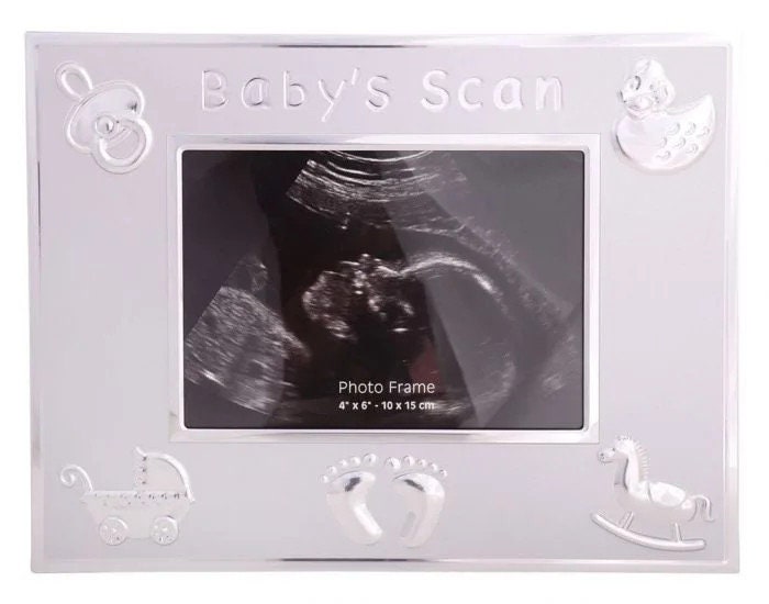 Baby's Scan Photo Album White Photo Album With Gorgeous