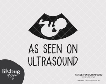 Download Ultrasound Baby Svg Etsy