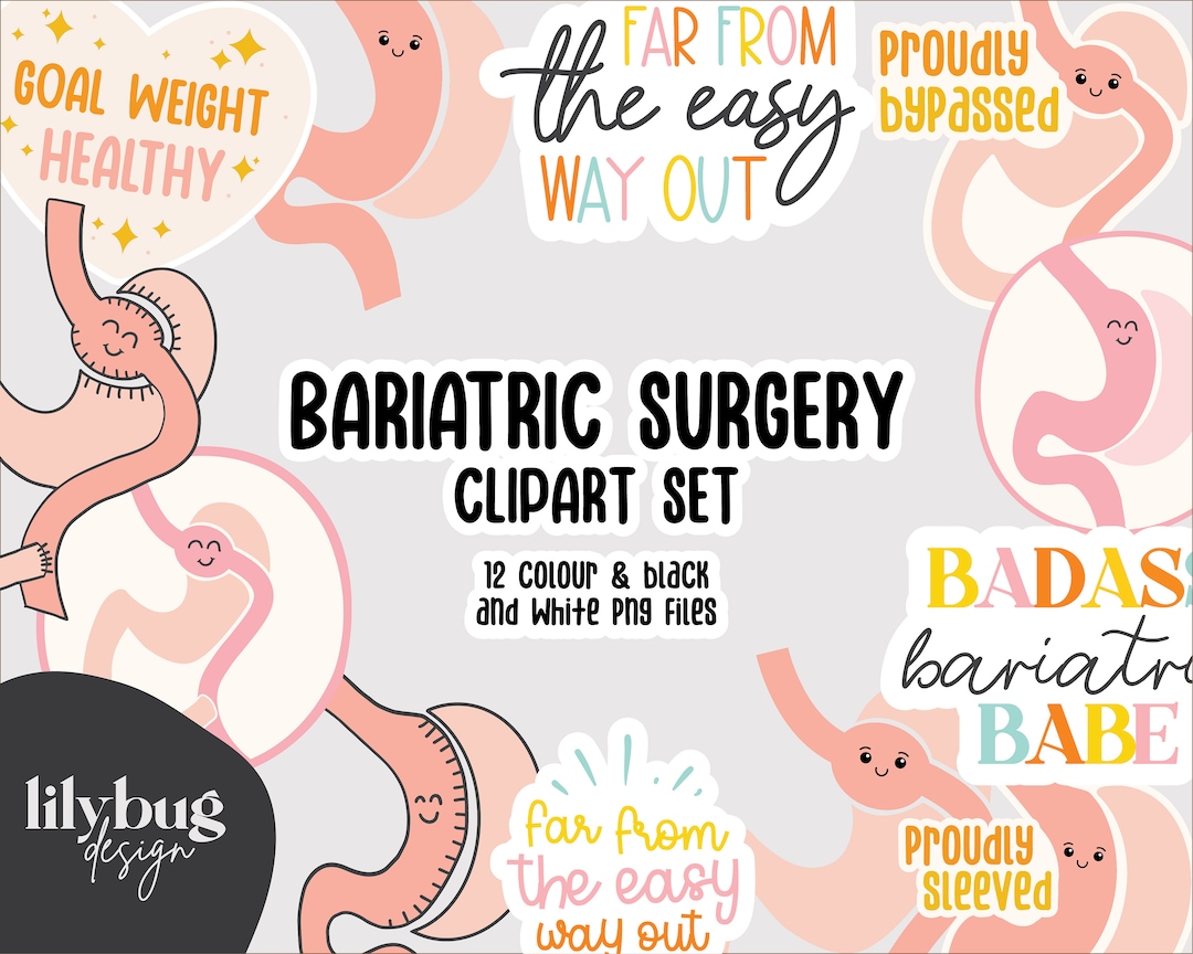 Bypass gástrico manga gástrica Juego de imágenes prediseñadas