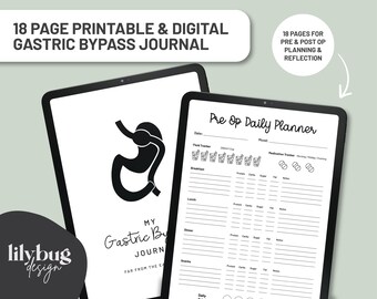 Magenbypass-Chirurgie Journal | Druckbarer bariatrischer Kalender | VSG & Abnehmen Chirurgische Tracker | Digitaler Download PDF JPEG