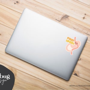 K&ouml;nnte beinhalten: Ein silberner Laptop mit einem Aufkleber eines Cartoon-Magens mit einem l&auml;chelnden Gesicht und dem Text "Proudly Bypassed".