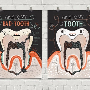 Anatomy of a Good Tooth and Bad Tooth: Two Art print Set