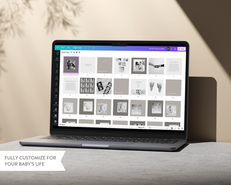 Puede incluir: Una pantalla de computadora port&aacute;til que muestra una interfaz de software de edici&oacute;n de fotos con una cuadr&iacute;cula de im&aacute;genes, incluidas fotos en blanco y negro de los pies, las manos y la cara de un beb&eacute;. El texto "FULLY CUSTOMIZE FOR YOUR BABY'S LIFE" se muestra debajo de la computadora port&aacute;til.