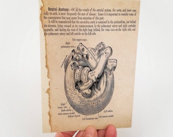 Anatomical heart, postcard, print, heart print, medical print, gothic postcard, gothic decor, anatomy print, original art, alternative print