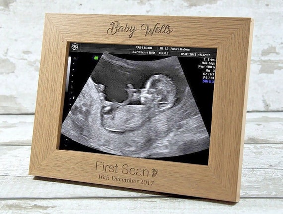 baby scan personalised frame