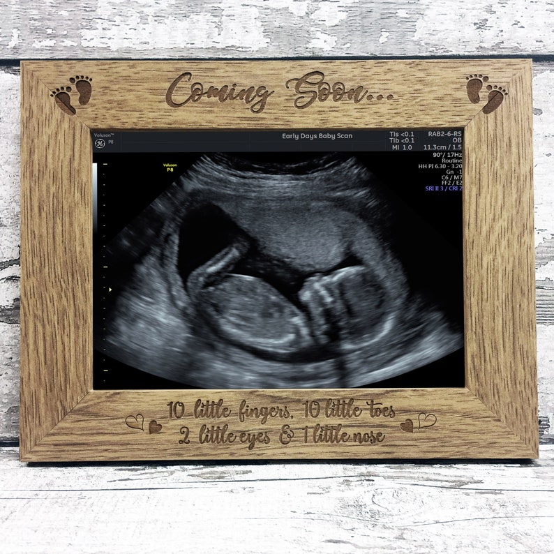 Baby Scan Photo Frame Baby Shower Gift or Pregnancy Etsy UK