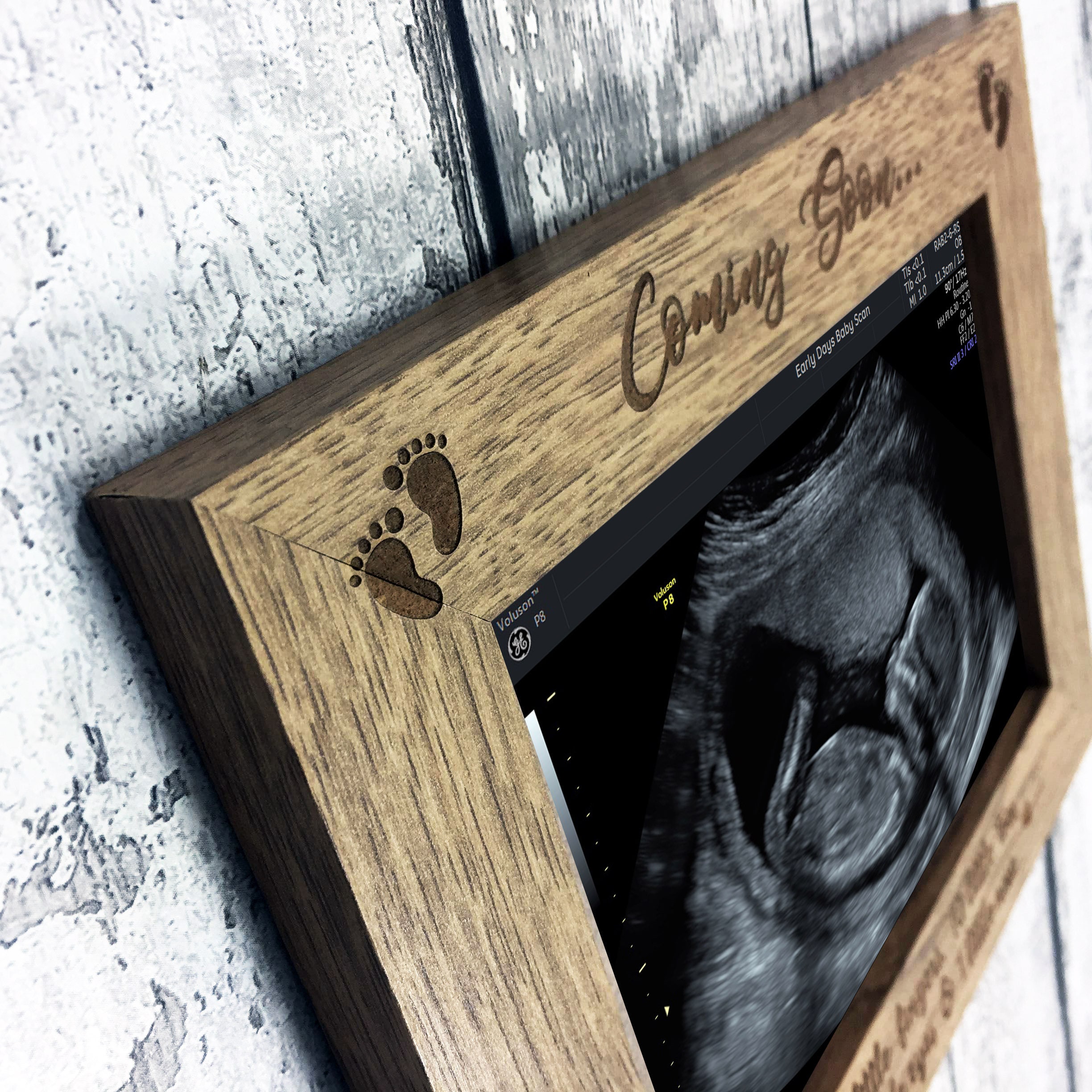 Baby Scan Photo Frame Baby Shower Gift or Pregnancy Etsy