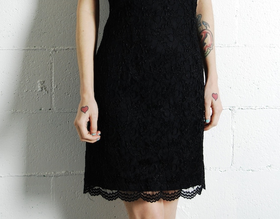 scalloped lace dress