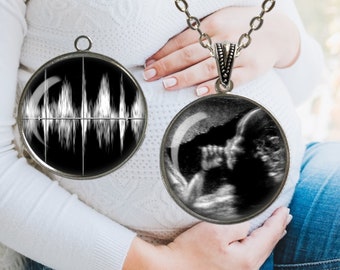 Baby Sonogram Necklace ~ Ultrasound Jewelry ~ Baby's HEARTBEAT - Sonogram Jewelry ~ Parents to Be ~ Sonogram Image ~ My Baby's Sonogram