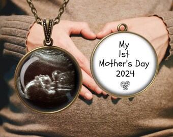 My First Mother's Day -  Sonogram Pendant Necklace - SONOGRAM - Baby Ultrasound Jewelry - Mom To Be Mothers Day - Mother to Be Gift