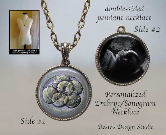 Custom IVF Sonogram Necklace: Embryo Keepsake Jewelry - Etsy