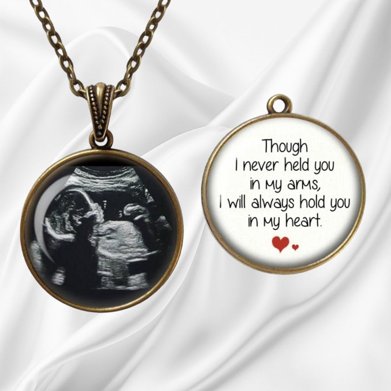 Miscarriage Keepsake Pendant Necklace Your Baby's SONOGRAM Ultrasound Baby Sonogram Jewelry Baby Memorial Jewelry Loss of Child image 1