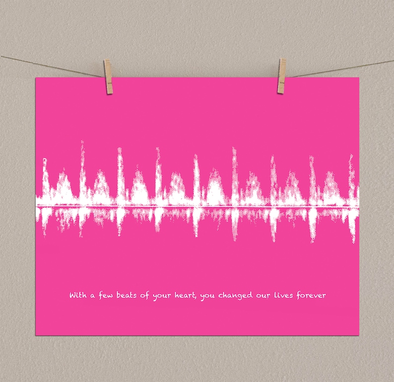 Baby Heartbeat Art Sonogram Gift Pregnancy Gift First Mothers Etsy